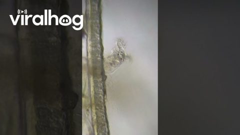 Rotifer Under a Microscope || ViralHog