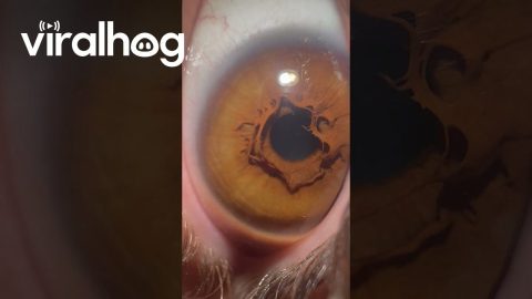 Unique Eye Iris || ViralHog