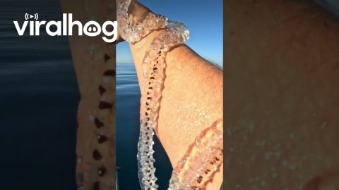 A Salp Bracelet || ViralHog