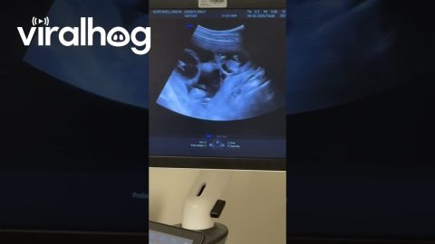Mom Learns She's Having Quadruplets || ViralHog