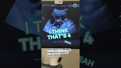 Mom Learns She's Having Quadruplets || ViralHog