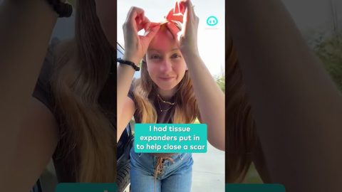 Bulbous Tissue Expanders Help Scars Heal || ViralHog Shorts